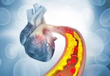 Understanding the Link Between Cholesterol and Heart Disease