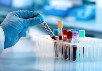 Routine Blood Tests: What They Can Reveal About Your Health